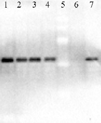 EGFP | Enhanced Green Fluorescence Protein in the group Antibodies for Human/Animal / Tag Antibodies / GFP/YFP/RFP/CFP at Agrisera AB (Antibodies for research) (AS13 2700)